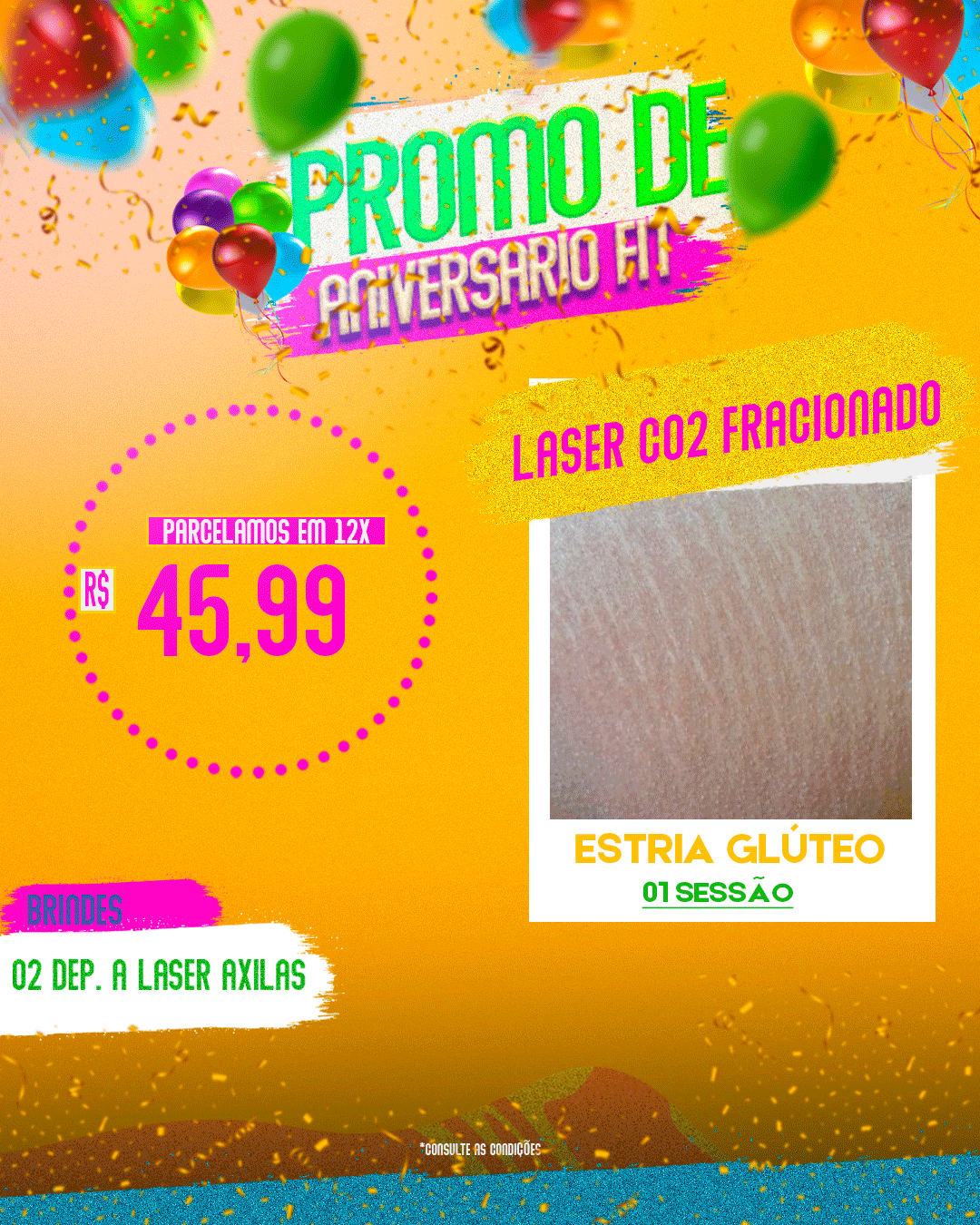 LASER CO2 FRACIONADO 01 SESSÃO GLÚTEOS ESTRIAS