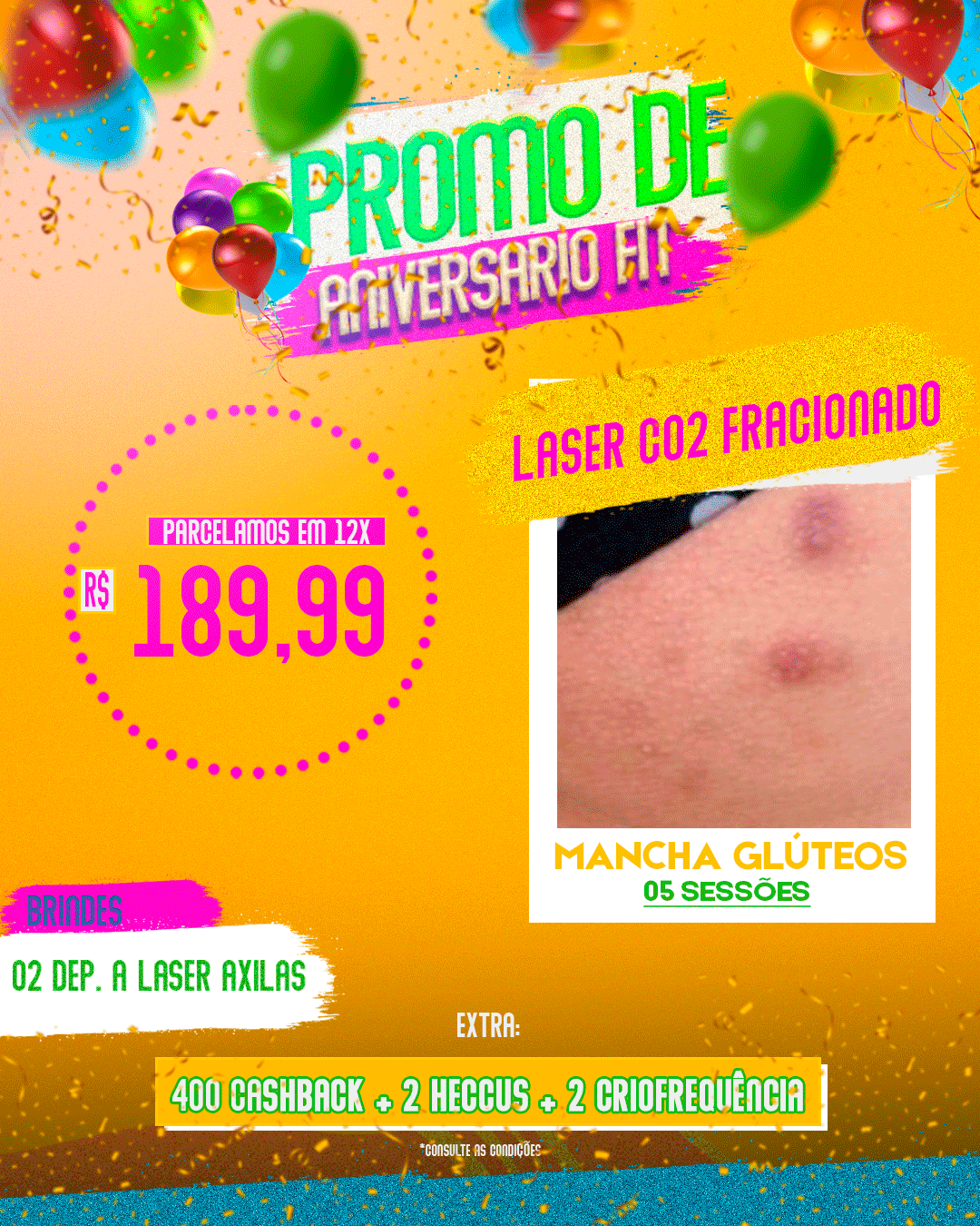 LASER CO2 FRACIONADO 05 SESSÕES MANCHA REGIÃO GLÚTEA.